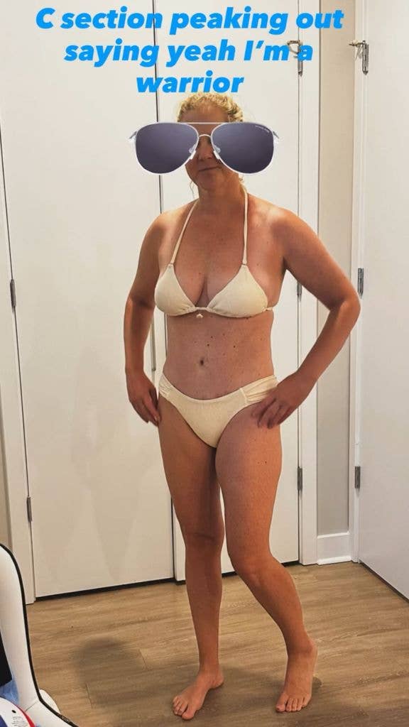 Screengrab of Amy Schumer's Stories showing her in a yellow bikini