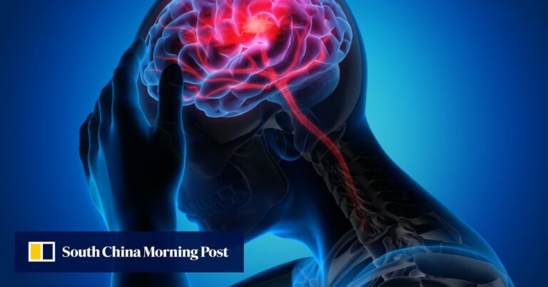 Chinese team’s wearable dopamine patch could be used to track depression