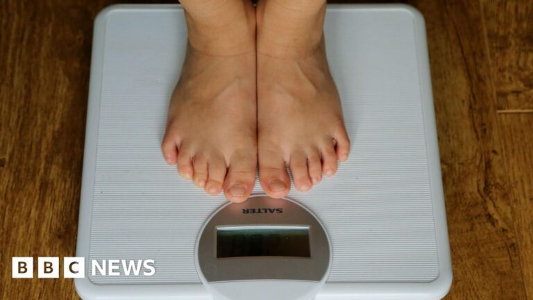 Obesity in Guernsey needs 'whole systems approach,' report says
