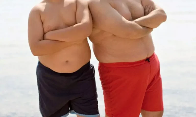 Childhood obesity rises in Italy despite Mediterranean diet heritage