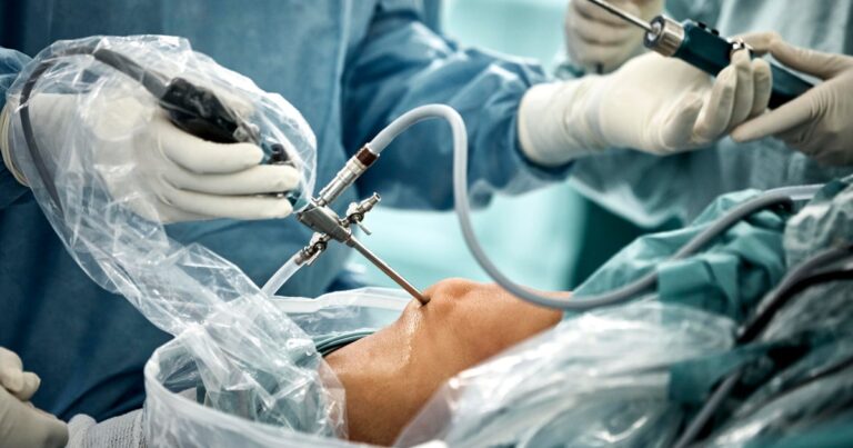 Common knee surgery may do more harm than good: “I don’t know how I would defend this procedure” Common knee surgery may do more harm than good: "I don't know how I would defend this procedure"