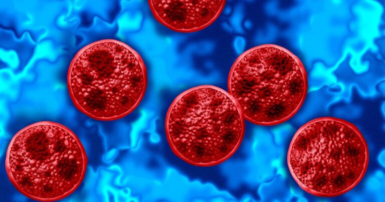 Michigan cyclosporiasis outbreak continues to spike, reaching 7,664 cases Michigan cyclosporiasis outbreak continues to spike, reaching 7,664 cases