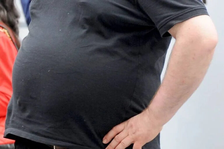 The ‘profound’ effects obesity has on careers with thousands out of work The 'profound' effects obesity has on careers with thousands out of work