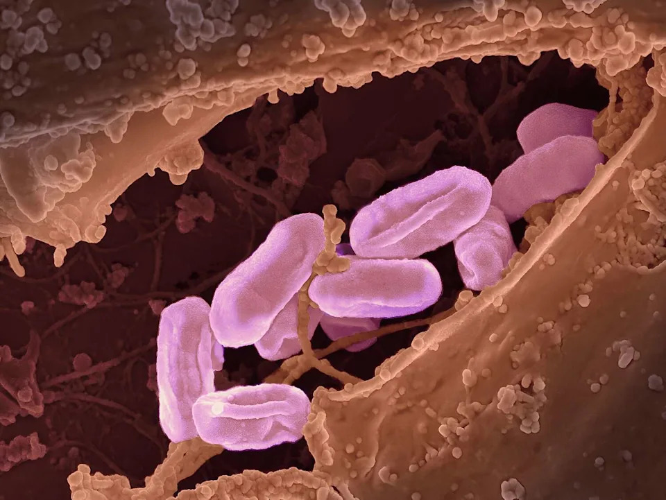Caused by the Rickettsia bacteria, murine typhus can be difficult to diagnose because its symptoms mimic those of a host of other diseases. (NIH-NIAID/Image Point FR/BSIP/Universal Images Group/Getty Images)
