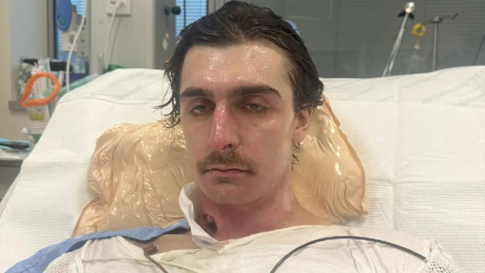 Lachie Perrem was left in a critical condition when the robotic cleaning device blew up in his face in the kitchen of his Brabham home. picture: GoFundMe