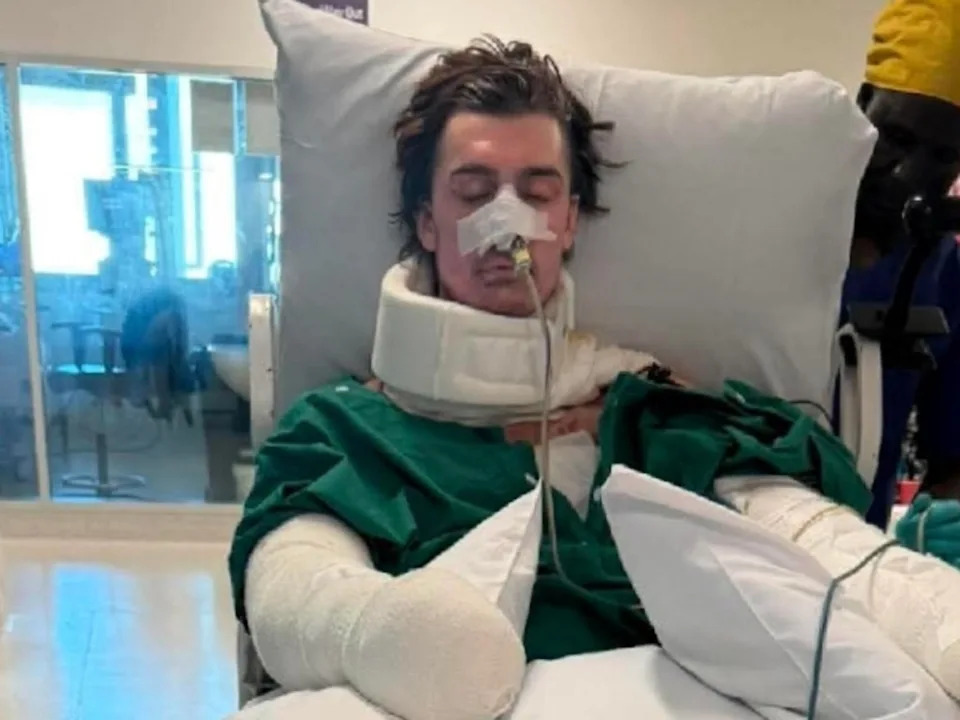 Lachie Perrem was left in a critical condition when the robotic cleaning device blew up in his face in the kitchen of his Brabham home. picture: GoFundMe