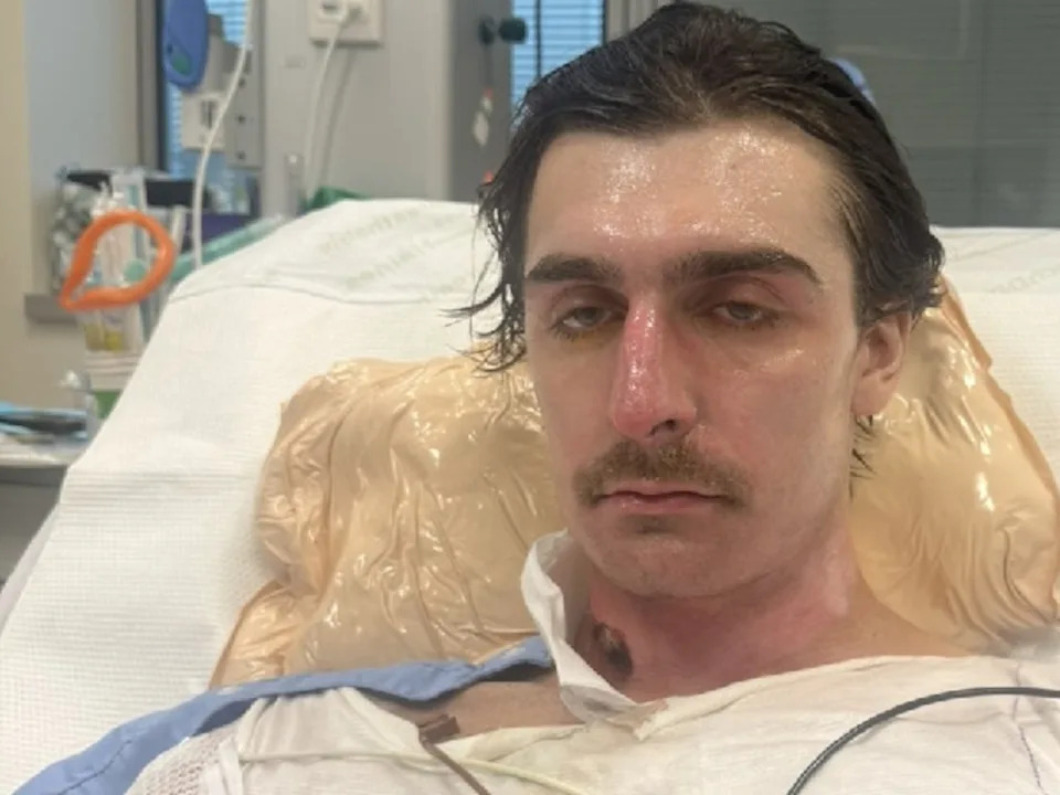 Lachie Perrem was left in a critical condition when the robotic cleaning device blew up in his face in the kitchen of his Brabham home. picture: GoFundMe