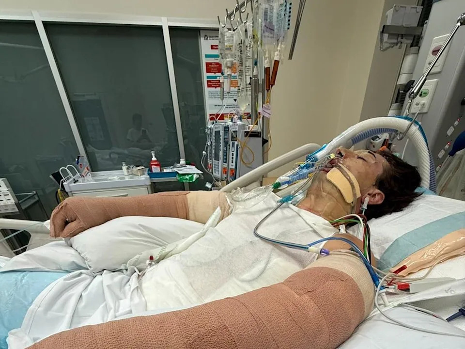 Lachie Perrem was left in a critical condition when the robotic cleaning device blew up in his face in the kitchen of his Brabham home. picture: GoFundMe
