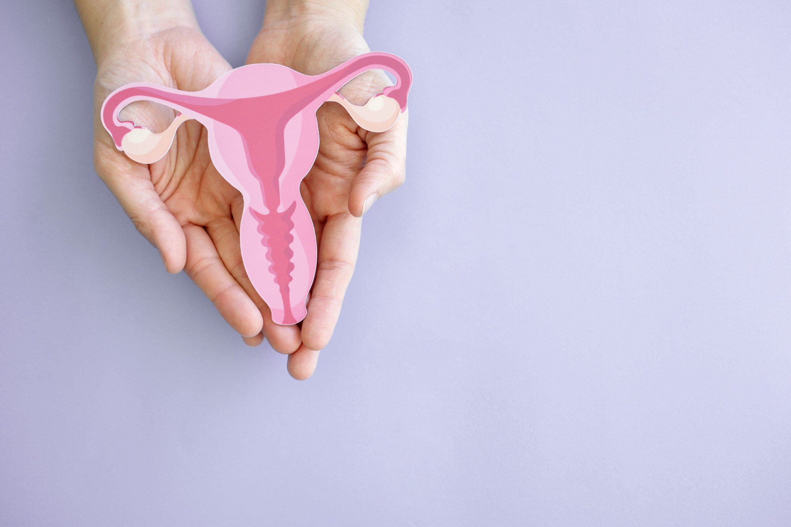 Endometriosis occurs when cells similar to the ones in the lining of the womb are found elsewhere in the body