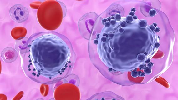 AML cells in blood flow