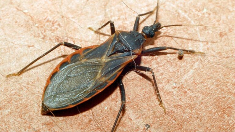 First locally acquired case of Chagas Disease reported in San Diego County First locally acquired case of Chagas Disease reported in San Diego County