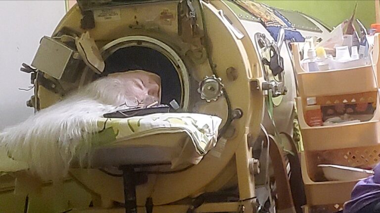 Last American to use an iron lung dies at 78 years old after childhood polio diagnosis Last American to use an iron lung dies at 78 years old after childhood polio diagnosis