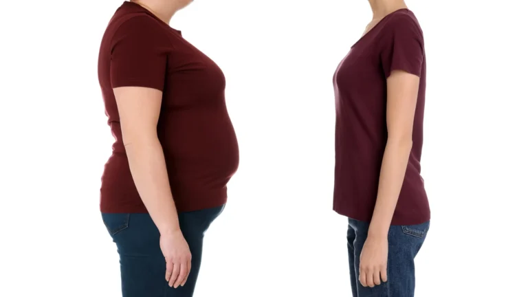 Why losing weight may not be enough to prevent type 2 diabetes