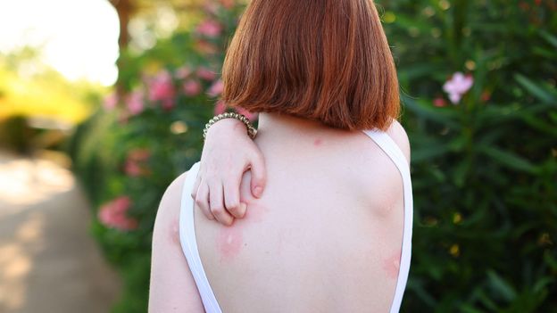 Why do mosquitoes bite some people more than others? Why do mosquitoes bite some people more than others?