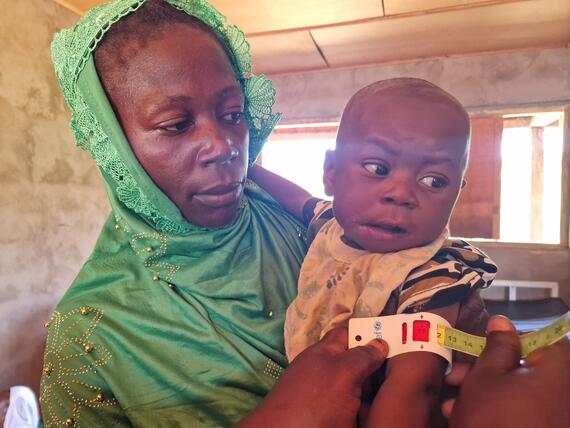 Health workers measure a child at Ouadda Nutrition Centre in the Central African Republic as part of screenings to detect malnutrition among children under 5. Photo: UNOCHA/Regis Maloundou
