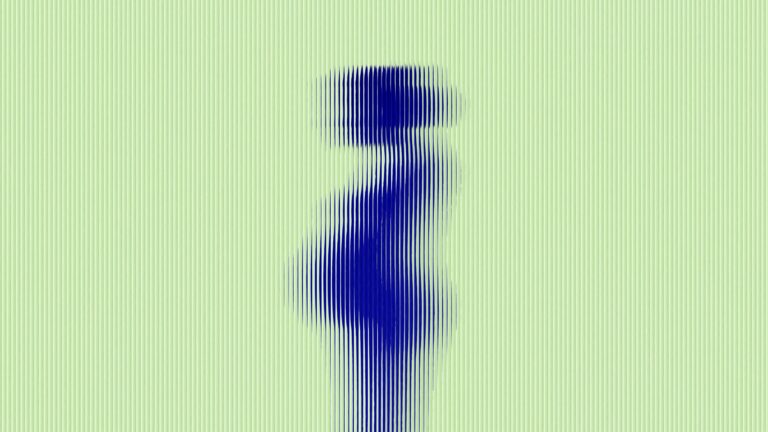 Postpartum Psychosis Is Rising. We Are Not Ready. Postpartum Psychosis Is Rising. We Are Not Ready.