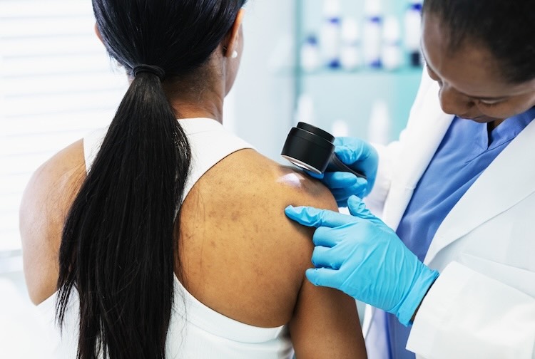 Dermatologist giving a medical exam to an woman. The patient is sitting on an examination table while the doctor examines the skin on her shoulder with a dermascope.