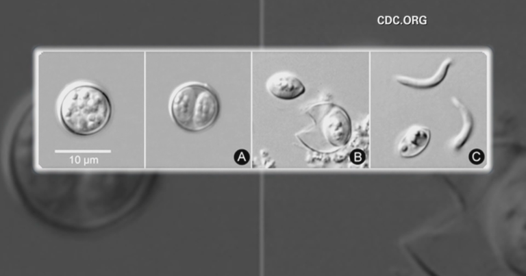 Michigan cyclosporiasis outbreak tops 6,500 cases, state health officials say Michigan cyclosporiasis outbreak tops 6,500 cases, state health officials say