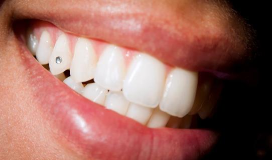 Mouth smiling showing gem on tooth