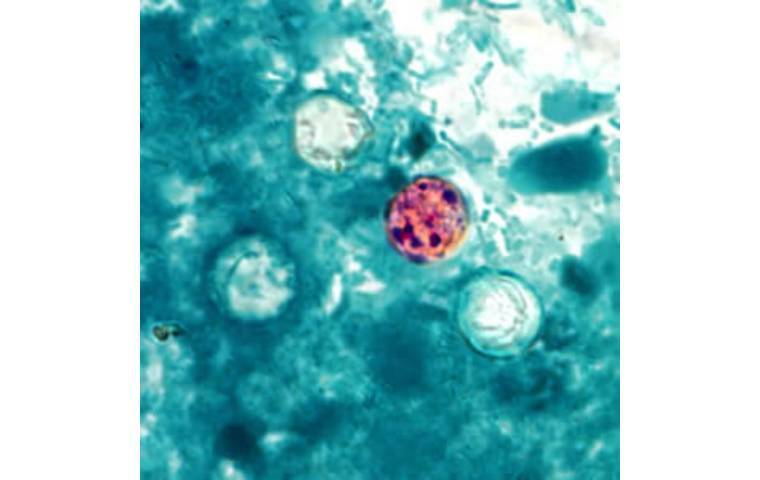 Health Department reports 2 new travel-related cyclosporiasis cases in Hawaii | Honolulu Star Health Department reports 2 new travel-related cyclosporiasis cases in Hawaii | Honolulu Star