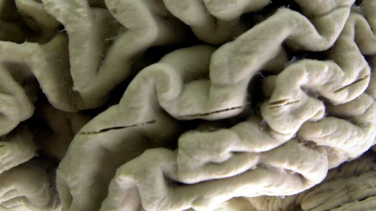 Study shows blood test can help identify people at high risk for Alzheimer's disease