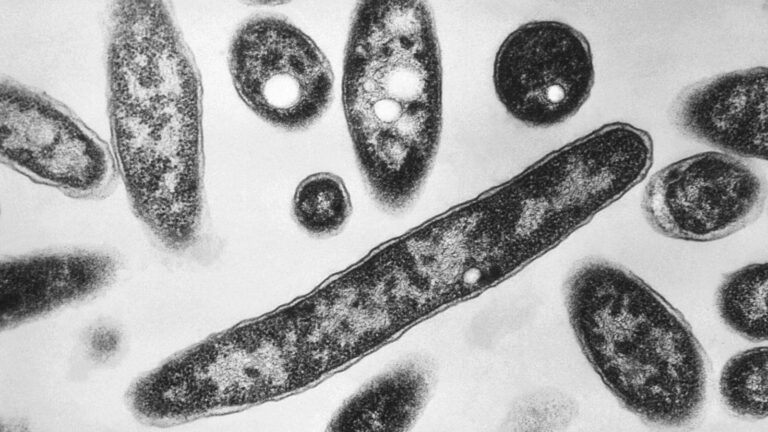 New diagnoses slow in NYC Legionnaires’ disease outbreak; source still unclear New diagnoses slow in NYC Legionnaires' disease outbreak; source still unclear