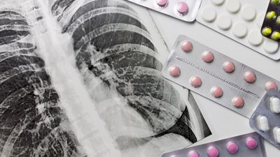 Chest X Ray and Pills.jpg