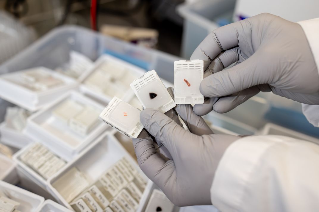 Biospecimens from the lab’s “tissue bank,”