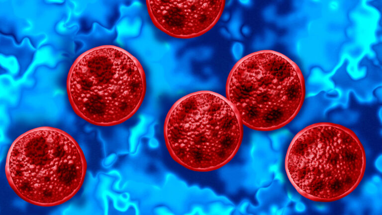 Michigan confirms first two deaths in cyclospora outbreak Michigan confirms first two deaths in cyclospora outbreak