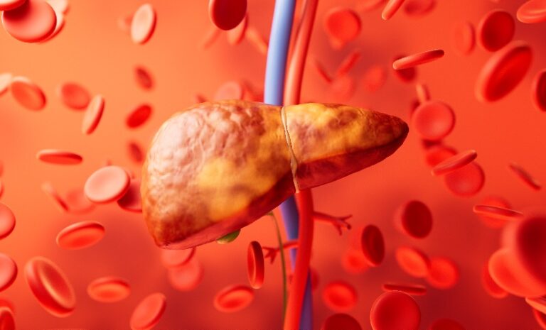 The Need for a More Dynamic Risk Assessment in Steatotic Liver Disease