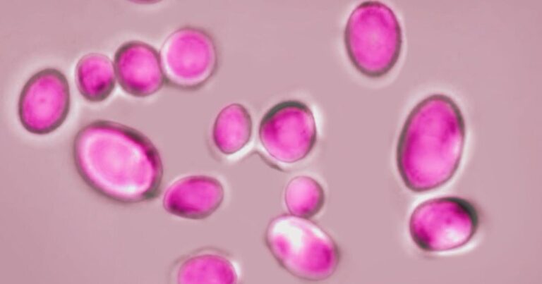 Drug-resistant fungas on the radar in Michigan as health experts monitor spread Drug-resistant fungas on the radar in Michigan as health experts monitor spread