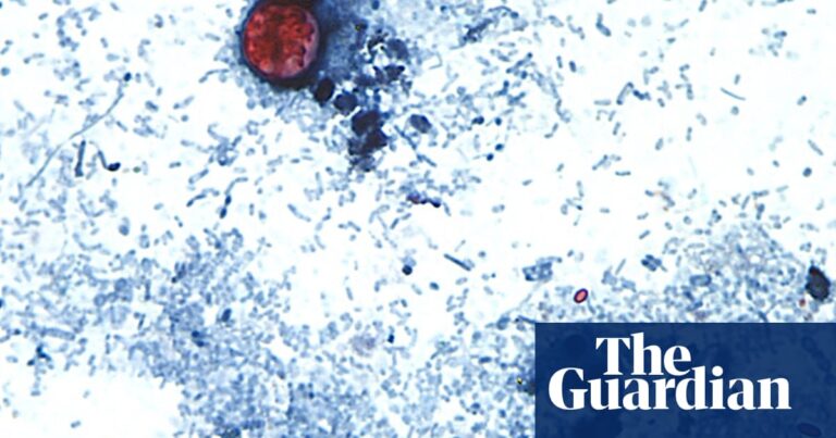 Is the cyclosporiasis outbreak slowing? Test