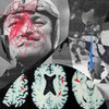 Everyday people fear they have CTE. A dubious market has sprung up to treat them