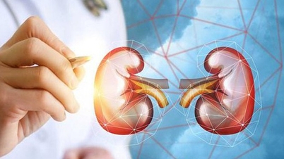 Urinary tract stones in children: Late detection can affect kidney function.