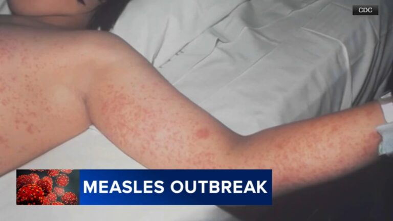 Measles exposure reported at Universal Studios Hollywood