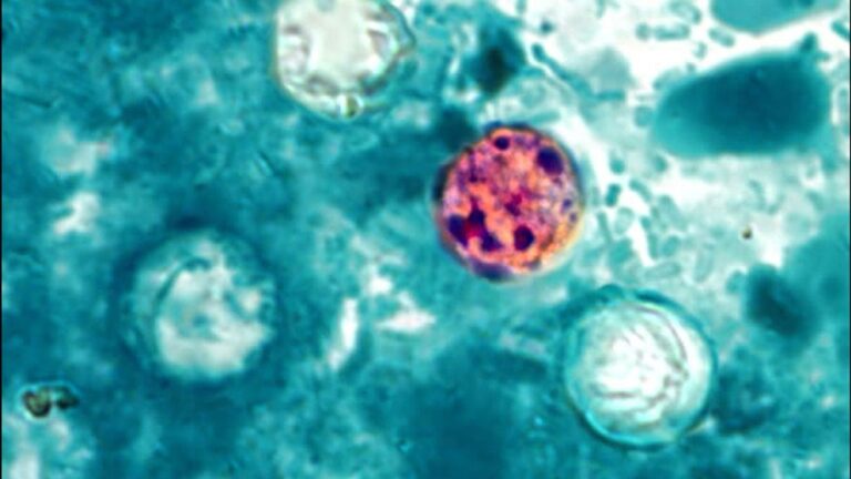 Arkansas Department of Health confirms 32 more Cyclosporiasis cases, total now 205