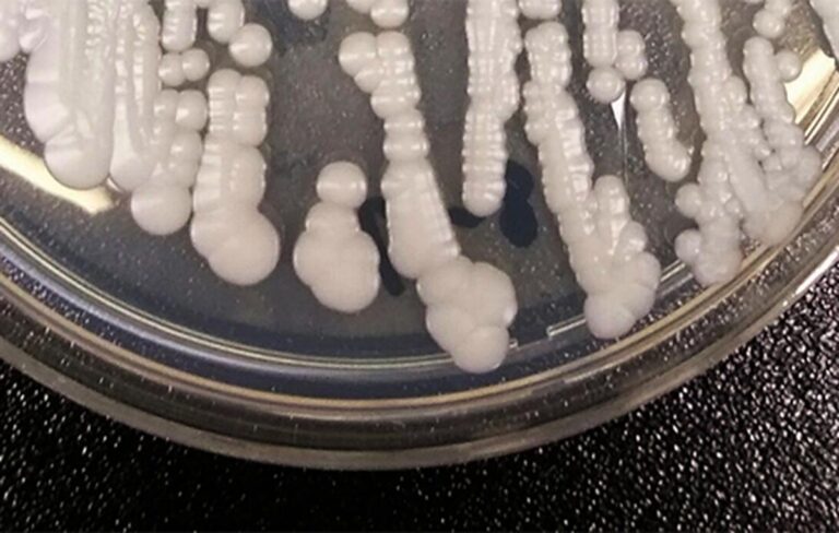 A fungus that can cause severe infections is spreading across U.S. CT doctors explain risks. A fungus that can cause severe infections is spreading across U.S. CT doctors explain risks.