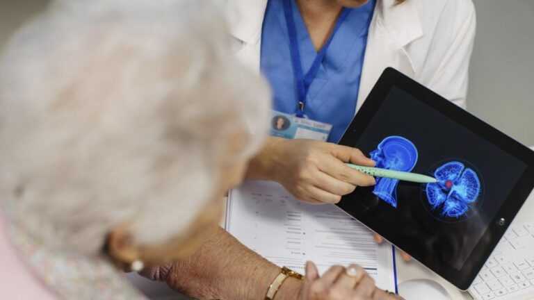 What doctors want patients to know about brain aneurysms