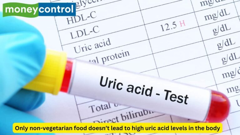 High uric acid diet: 5 foods and drinks to avoid to prevent gout and kidney stones