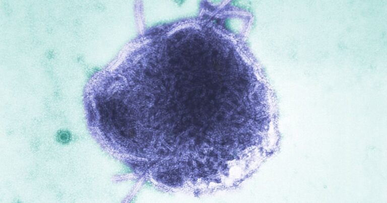Infant in Pennsylvania is one of two people reported to die of measles this week
