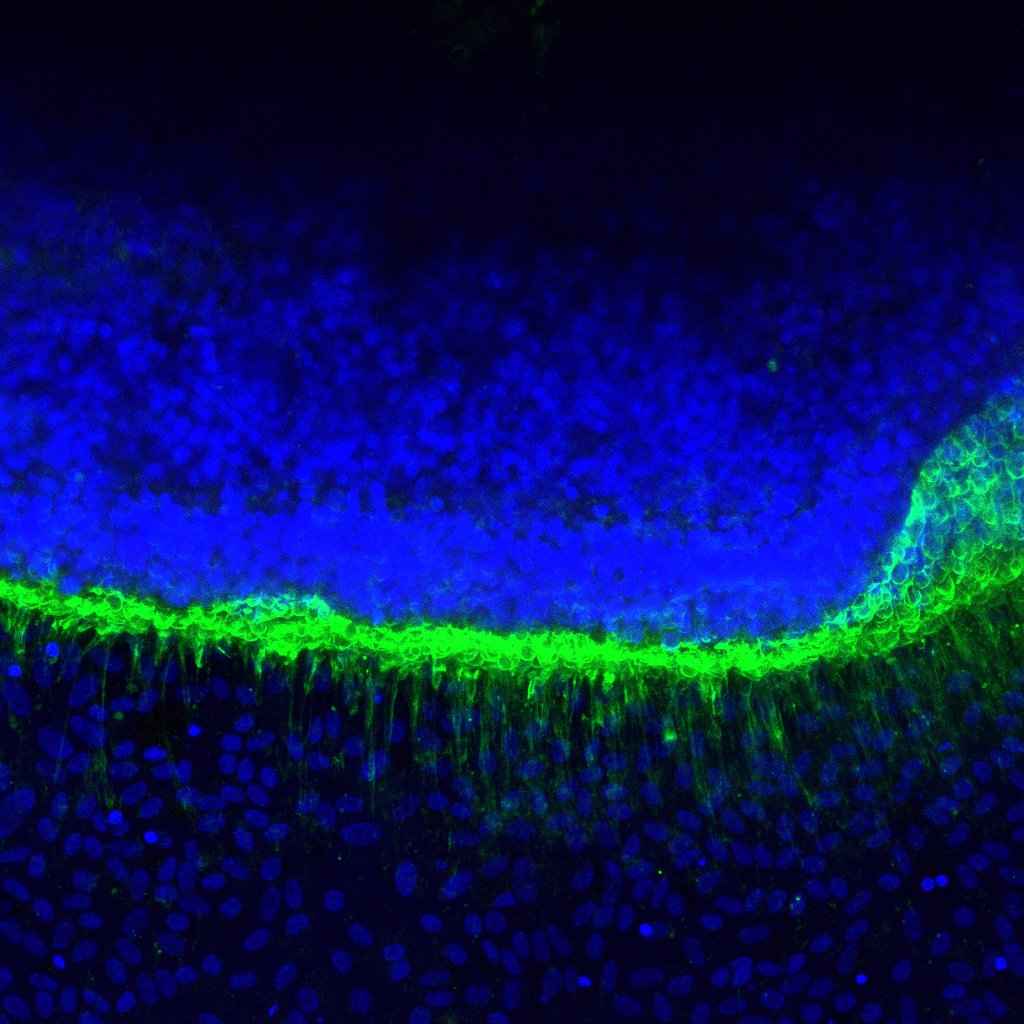 This image shows photoreceptor outer segments (green) extending into the underlying retinal pigment epithelium (RPE), illustrating the interaction between these key retinal cells.