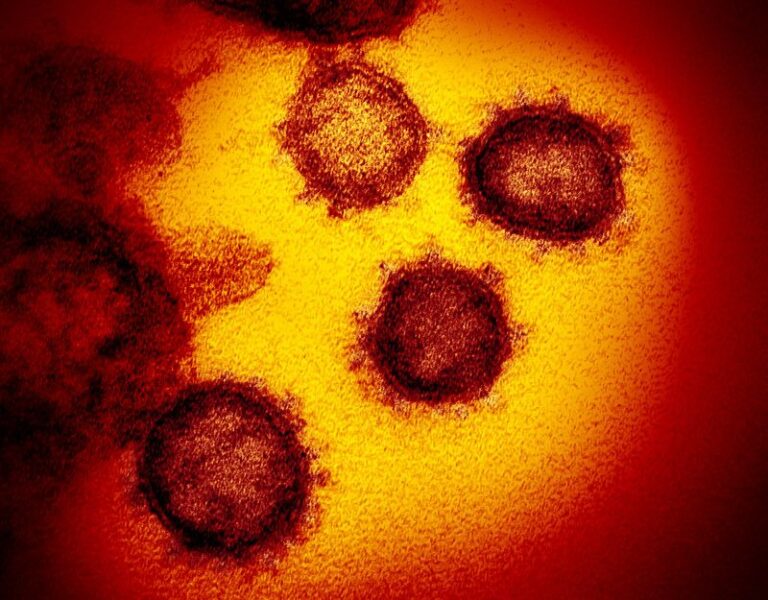 Covid-19 Can Reawaken Dormant Viruses in the Body, Which Might Worsen Symptoms of the Respiratory Illness, Study Suggests