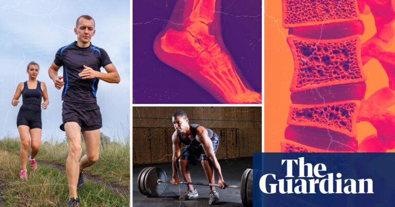‘I spent a week crying. I’ve never had an injury in my life!’ Why do so many fitness fans end up needing surgery?