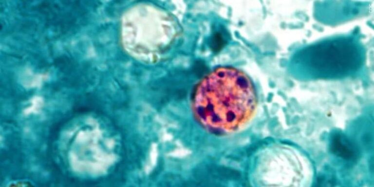 Cyclosporiasis outbreak linked to iceberg lettuce reaches Maine Cyclosporiasis outbreak linked to iceberg lettuce reaches Maine