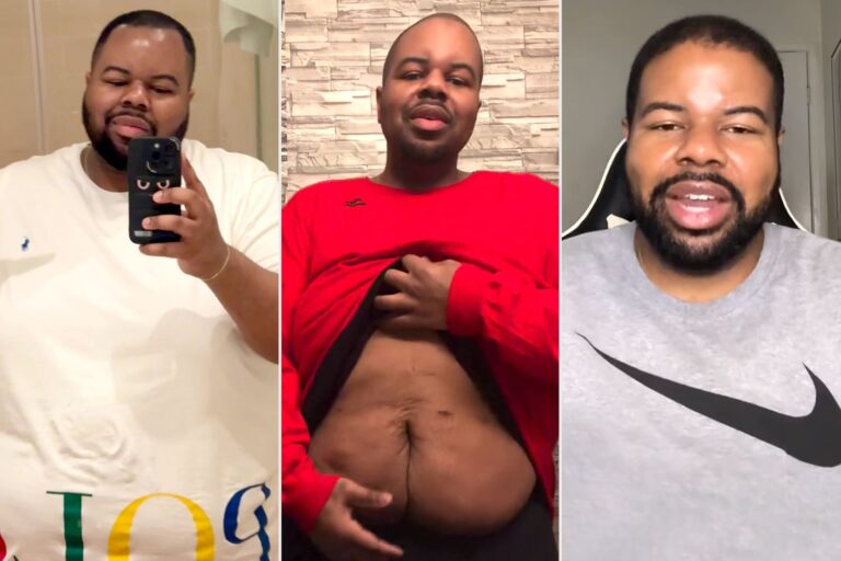 “90 Day Fiancé ”Star Says He Doesn’t Feel Like a ‘Scary Beast’ Anymore After Weight Loss and Hair Transplant (Exclusive)