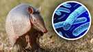 Leprosy on the rise in Florida. Are armadillos to blame?