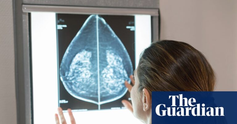 AI can detect heart disease in women using mammograms, study suggests AI can detect heart disease in women using mammograms, study suggests
