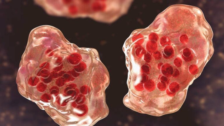 Georgia confirms 7th measles case of 2026 in unvaccinated resident