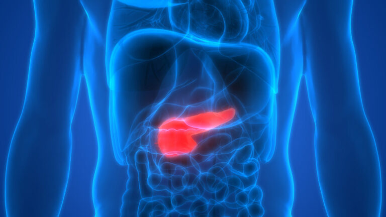A New Hope for Pancreatic Cancer