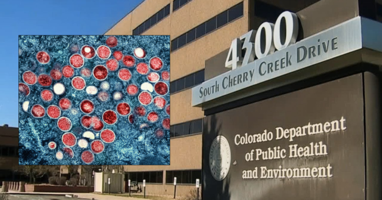 Colorado sees summer surge in Mpox infections Colorado sees summer surge in Mpox infections